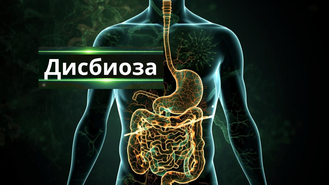 Дисбиоза и чревен микробиом - блог от Nucleo Greens